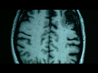 bbc. secrets of the brain 4th series. first among equals (brain story)