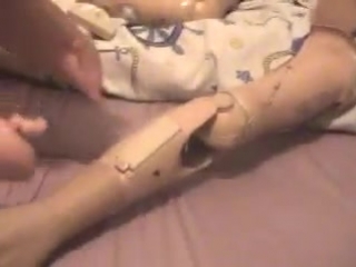 ana bordeianu prosthetics